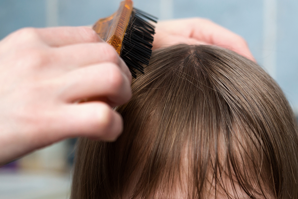 Alcohol bencílico contra los piojos y liendres | Blog | EIOS Logistics